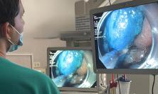 Tecnologia giapponese per la prima volta alle Marche: riuscito intervento di dissezione endoscopica