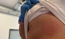 Porto Recanati, operatrice sanitaria aggredita durante un intervento: Ugl chiede bodycam