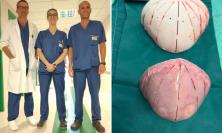 Ancona, intervento chirurgico d'avanguardia: neonato di 9 mesi operato per rara malformazione al cranio