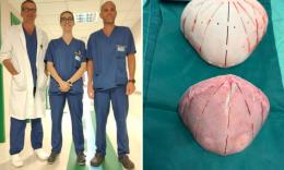 Ancona, intervento chirurgico d'avanguardia: neonato di 9 mesi operato per rara malformazione al cranio