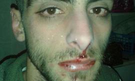 Macerata violenta: imbianchino preso a pugni in testa e rapinato mentre stava chiudendo il furgone