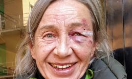 Macerata, Natale e Capodanno da incubo in provincia: escalation di aggressioni e rapine