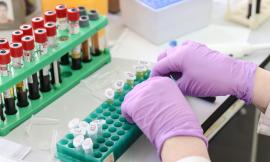 Coronavirus Marche, 16 nuovi casi nelle ultime 24 ore: oltre mille i tamponi effettuati