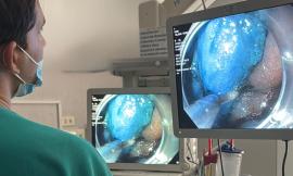 Tecnologia giapponese per la prima volta alle Marche: riuscito intervento di dissezione endoscopica