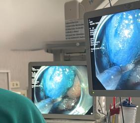 Tecnologia giapponese per la prima volta alle Marche: riuscito intervento di dissezione endoscopica