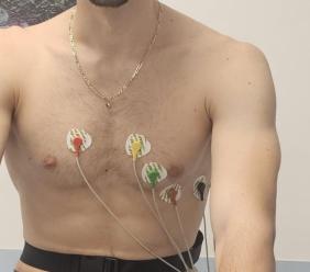 Omicidio colposo e medico sportivo: quando il certificato di idoneità causa la morte dell’atleta