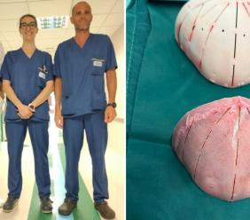 Ancona, intervento chirurgico d'avanguardia: neonato di 9 mesi operato per rara malformazione al cranio Ancona, intervento chirurgico d'avanguardia: neonato di 9 mesi operato per rara malformazione al cranio