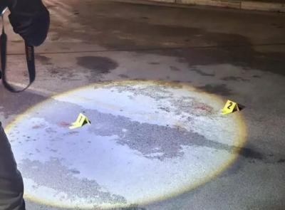 Aggredito mentre passeggia con il cane: 70enne ricoverato in gravi condizioni