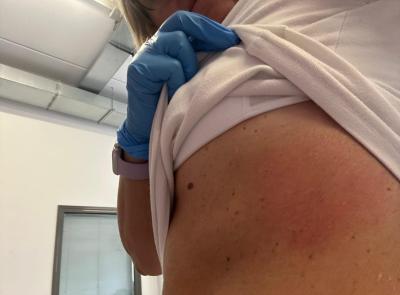 Porto Recanati, operatrice sanitaria aggredita durante un intervento: Ugl chiede bodycam