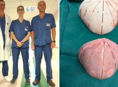 Ancona, intervento chirurgico d'avanguardia: neonato di 9 mesi operato per rara malformazione al cranio