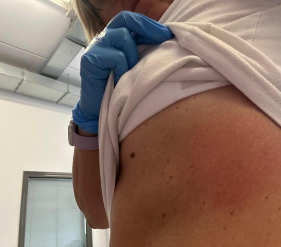 Porto Recanati, operatrice sanitaria aggredita durante un intervento: Ugl chiede bodycam