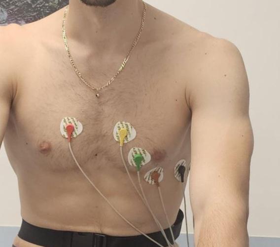 Omicidio colposo e medico sportivo: quando il certificato di idoneità causa la morte dell’atleta