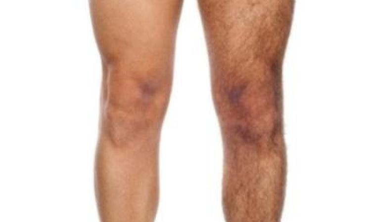 Si rifiuta di depilare un uomo nelle parti intime: estetista licenziata