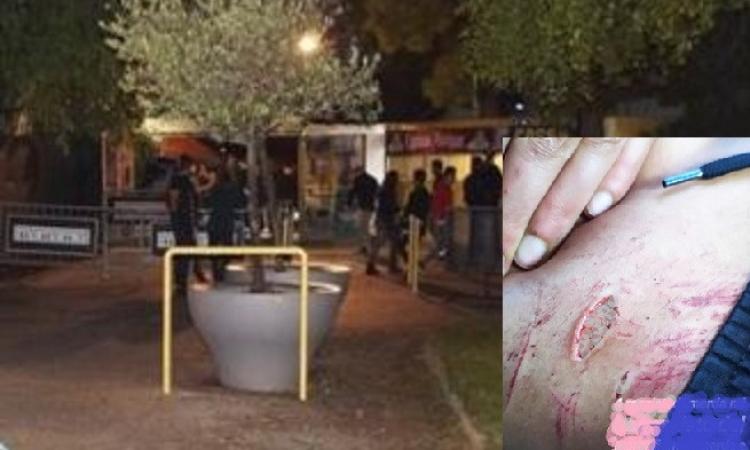 Aggressione razzista al Mamamia di Senigallia: "Calci, pugni e poi una coltellata". Coinvolto anche un buttafuori Aggressione razzista al Mamamia di Senigallia: "Calci, pugni e poi una coltellata". Coinvolto anche un buttafuori