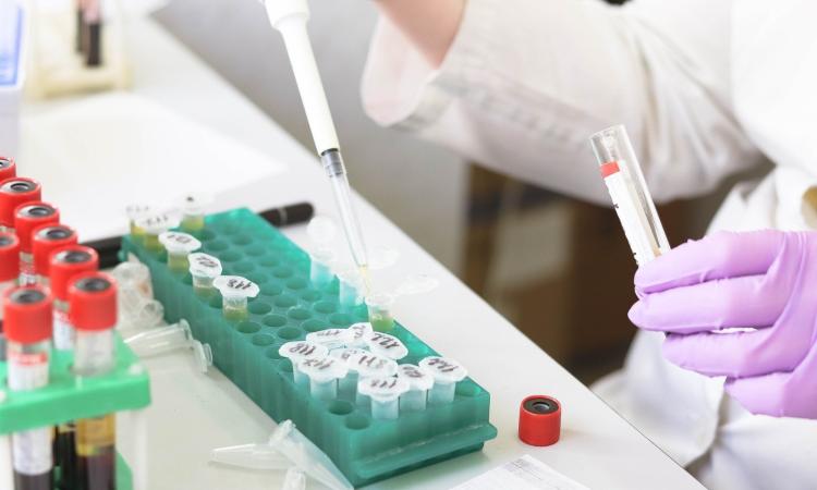 Coronavirus, nelle Marche 159 tamponi positivi: salgono a 7 i casi in provincia di Macerata