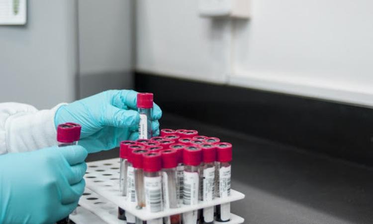 Coronavirus, altri 5 tamponi positivi nelle Marche: salgono a 11 i contagiati