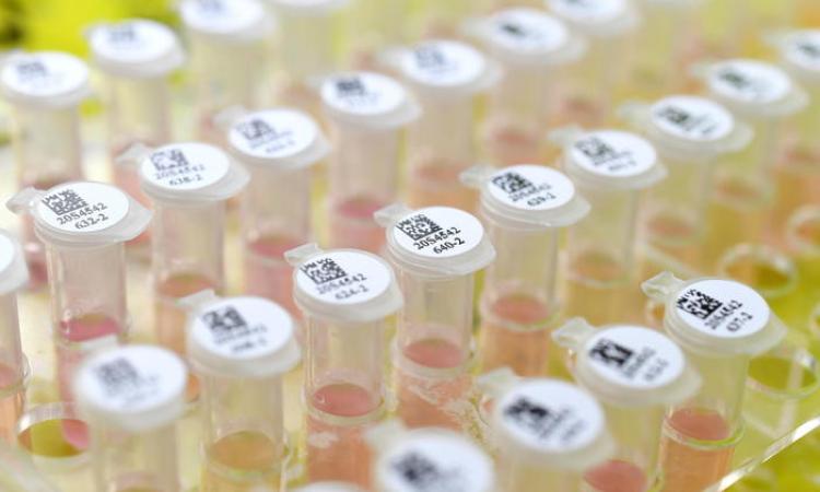 Coronavirus: nelle Marche 61 casi positivi, salgono a 2 nel Maceratese Coronavirus: nelle Marche 61 casi positivi, salgono a 2 nel Maceratese