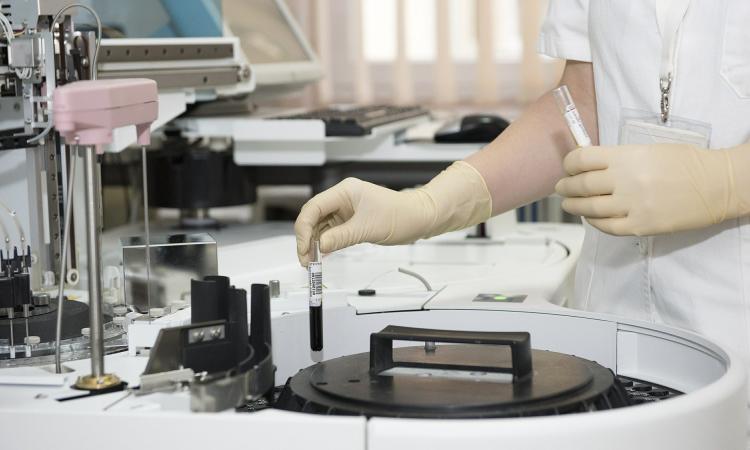 Coronavirus Marche, scende la curva dei contagiati: 96 nuovi casi su 700 tamponi effettuati
