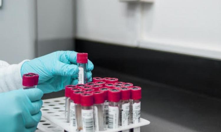 Coronavirus Marche, 92 nuovi casi nelle ultime 24 ore: il dato più basso dal 10 marzo Coronavirus Marche, 92 nuovi casi nelle ultime 24 ore: il dato più basso dal 10 marzo
