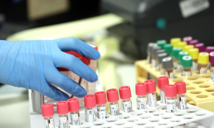 Coronavirus Marche, 29 nuovi casi su oltre 1200 tamponi analizzati Coronavirus Marche, 29 nuovi casi su oltre 1200 tamponi analizzati