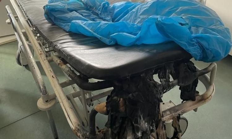Paziente ubriaco appicca incendio al pronto soccorso: attimi di panico all'ospedale Torrette Paziente ubriaco appicca incendio al pronto soccorso: attimi di panico all'ospedale Torrette