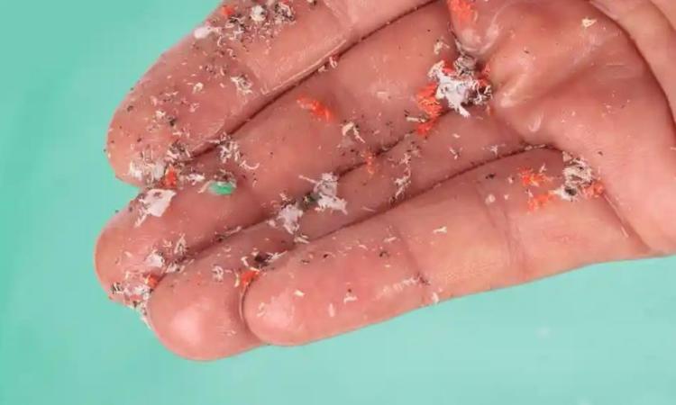 "Microplastiche nelle placche delle arterie umane": nella scoperta scientifica 'rivoluzionaria' c'è anche la Politecnica delle Marche "Microplastiche nelle placche delle arterie umane": nella scoperta scientifica 'rivoluzionaria' c'è anche la Politecnica delle Marche