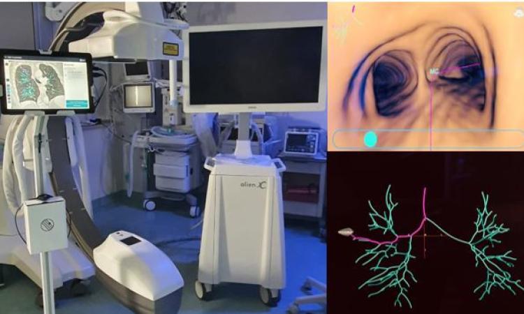 Ad Ancona arriva l'intelligenza artificiale per la diagnosi precoce delle lesioni nodulari polmonari Ad Ancona arriva l'intelligenza artificiale per la diagnosi precoce delle lesioni nodulari polmonari