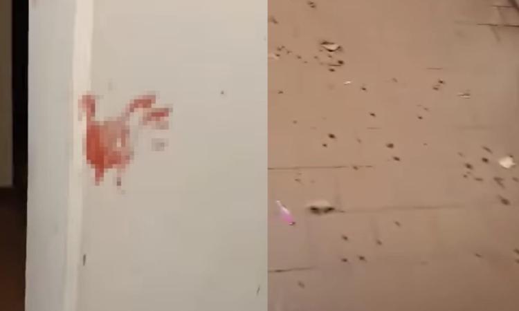 Violenta aggressione a Porto Recanati: uomo ferito appena uscito da casa. Indagini in corso Violenta aggressione a Porto Recanati: uomo ferito appena uscito da casa. Indagini in corso