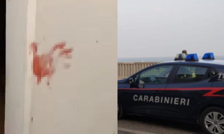 Porto Recanati, raid sotto casa: operaio aggredito a colpi di spranga, arrestati due uomini Porto Recanati, raid sotto casa: operaio aggredito a colpi di spranga, arrestati due uomini