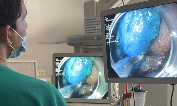 Tecnologia giapponese per la prima volta alle Marche: riuscito intervento di dissezione endoscopica