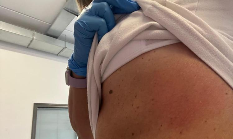 Porto Recanati, operatrice sanitaria aggredita durante un intervento: Ugl chiede bodycam