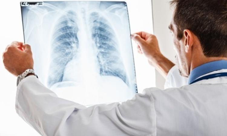 Santo Stefano: una mattinata dedicata alle patologie dell'apparato respiratorio